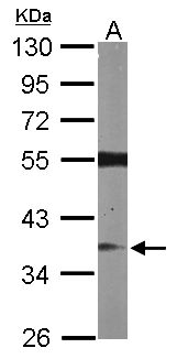 RASSF2 Antibody - Sample (50 ug of whole cell lysate). A: Mouse brain. 10% SDS PAGE. RASSF2 antibody diluted at 1:1000.