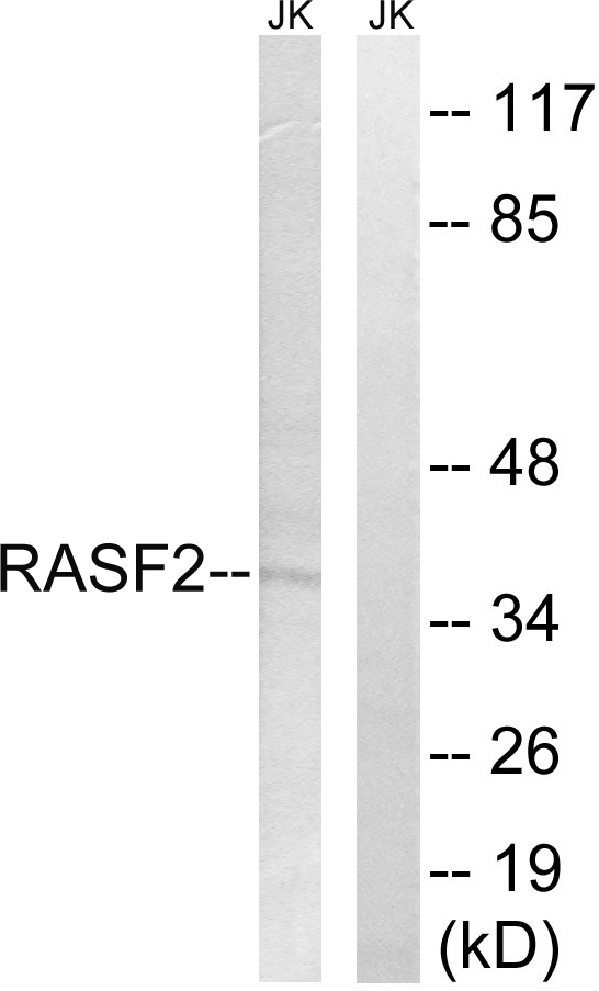 RASSF2 Antibody - Western blot analysis of lysates from Jurkat cells, using RASSF2 Antibody. The lane on the right is blocked with the synthesized peptide.
