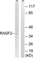 RASSF2 Antibody - Western blot analysis of lysates from Jurkat cells, using RASSF2 Antibody. The lane on the right is blocked with the synthesized peptide.