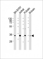 RASSF2 Antibody - All lanes: Anti-RASSF2 Antibody (Center) at 1:2000 dilution. Lane 1: SH-SY5Y whole cell lysates. Lane 2: Jurkat whole cell lysates. Lane 3: human brain lysates. Lane 4: mouse brain lysates Lysates/proteins at 20 ug per lane. Secondary Goat Anti-Rabbit IgG, (H+L), Peroxidase conjugated at 1:10000 dilution. Predicted band size: 38 kDa. Blocking/Dilution buffer: 5% NFDM/TBST.
