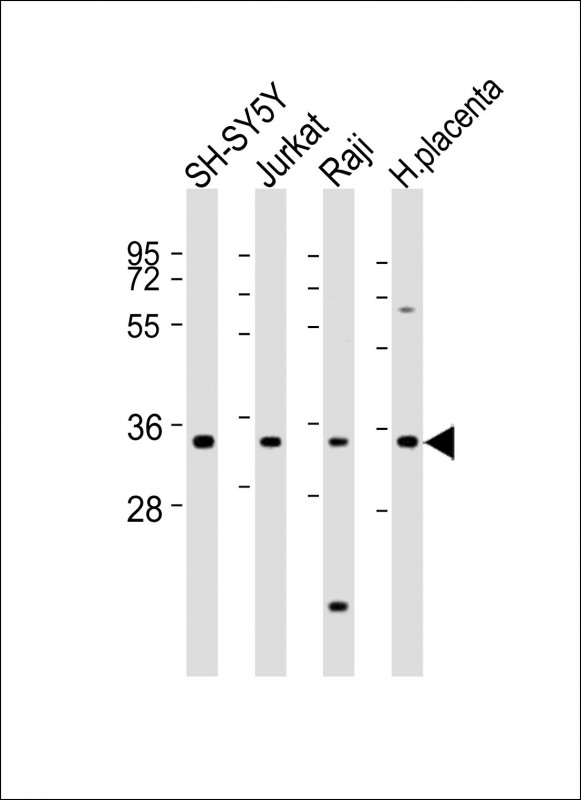 RASSF2 Antibody - All lanes: Anti-RASSF2 Antibody (Center) at 1:2000 dilution. Lane 1: SH-SY5Y whole cell lysates. Lane 2: Jurkat whole cell lysates. Lane 3: Raji whole cell lysates. Lane 4: human placenta lysates Lysates/proteins at 20 ug per lane. Secondary Goat Anti-Rabbit IgG, (H+L), Peroxidase conjugated at 1:10000 dilution Predicted band size: 38 kDa. Blocking/Dilution buffer: 5% NFDM/TBST.