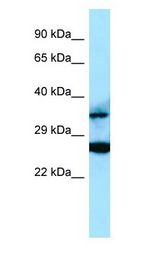 RASSF2 Antibody - RASSF2 antibody Western Blot of Placenta.  This image was taken for the unconjugated form of this product. Other forms have not been tested.