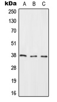 RASSF2 Antibody - Western blot analysis of RASSF2 expression in HeLa (A); NIH3T3 (B); H9C2 (C) whole cell lysates.