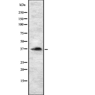 RASSF2 Antibody - Western blot analysis of RASSF2 using HepG2 whole cells lysates