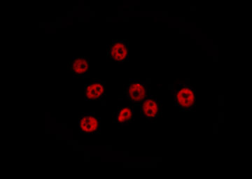 RASSF2 Antibody - Staining HeLa cells by IF/ICC. The samples were fixed with PFA and permeabilized in 0.1% Triton X-100, then blocked in 10% serum for 45 min at 25°C. The primary antibody was diluted at 1:200 and incubated with the sample for 1 hour at 37°C. An Alexa Fluor 594 conjugated goat anti-rabbit IgG (H+L) antibody, diluted at 1/600, was used as secondary antibody.