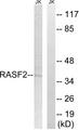 RASSF2 Antibody - Western blot analysis of extracts from Jurkat cells, using RASSF2 antibody.