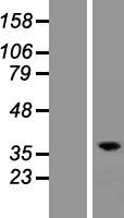 RASSF2 Protein - Western validation with an anti-DDK antibody * L: Control HEK293 lysate R: Over-expression lysate