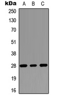 RASSF3 Antibody - Western blot analysis of RASSF3 expression in MCF7 (A); Raw264.7 (B); PC12 (C) whole cell lysates.