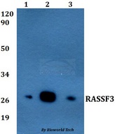RASSF3 Antibody - Western blot of RASSF3 antibody at 1:500 dilution. Lane 1: MCF-7 whole cell lysate. Lane 2: Raw264.7 whole cell lysate. Lane 3: PC12 whole cell lysate.