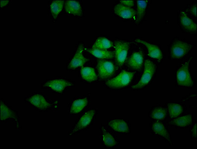 RASSF3 Antibody - Immunofluorescence staining of A549 cells diluted at 1:100, counter-stained with DAPI. The cells were fixed in 4% formaldehyde, permeabilized using 0.2% Triton X-100 and blocked in 10% normal Goat Serum. The cells were then incubated with the antibody overnight at 4°C.The Secondary antibody was Alexa Fluor 488-congugated AffiniPure Goat Anti-Rabbit IgG (H+L).
