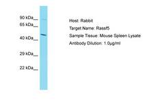 RASSF5 / RAPL Antibody -  This image was taken for the unconjugated form of this product. Other forms have not been tested.