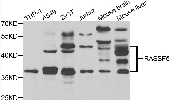 RASSF5 / RAPL Antibody - Western blot analysis of extracts of various cell lines.