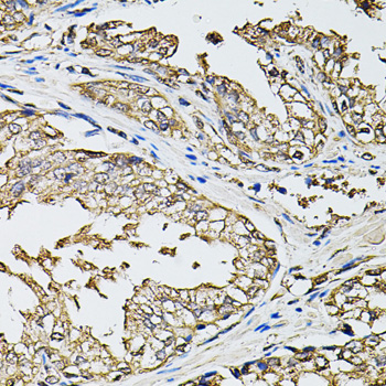 RASSF5 / RAPL Antibody - Immunohistochemistry of paraffin-embedded human prostate tissue.