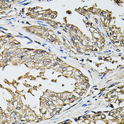 RASSF5 / RAPL Antibody - Immunohistochemistry of paraffin-embedded human prostate tissue.