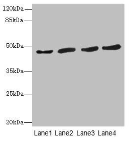 RASSF5 / RAPL Antibody - Western blot All Lanes: RASSF5antibody at 5.46ug/ml Lane 1 : Thp-1 whole cell lysate Lane 2 : 293T whole cell lysate Lane 3 : Jurkat whole cell lysate Lane 4 : A549 whole cell lysate Secondary Goat polyclonal to Rabbit IgG at 1/10000 dilution Predicted band size: 48,31,38 kDa Observed band size: 47 kDa