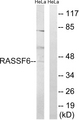RASSF6 Antibody - Western blot analysis of lysates from HeLa cells, using RASSF6 Antibody. The lane on the right is blocked with the synthesized peptide.