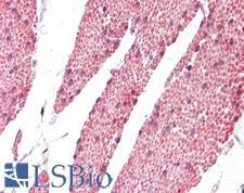 RASSF6 Antibody - Human Small Intestine: Formalin-Fixed, Paraffin-Embedded (FFPE).  This image was taken for the unconjugated form of this product. Other forms have not been tested.