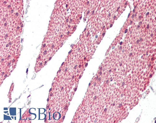 RASSF6 Antibody - Human Small Intestine: Formalin-Fixed, Paraffin-Embedded (FFPE).  This image was taken for the unconjugated form of this product. Other forms have not been tested.