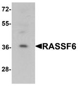 RASSF6 Antibody - Western blot analysis of RASSF6 in 293 cell lysate with RASSF6 antibody at 1 ug/ml.