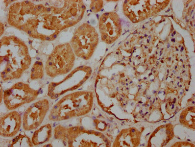 RASSF6 Antibody - IHC image of RASSF6 Antibody diluted at 1:263 and staining in paraffin-embedded human kidney tissue performed on a Leica BondTM system. After dewaxing and hydration, antigen retrieval was mediated by high pressure in a citrate buffer (pH 6.0). Section was blocked with 10% normal goat serum 30min at RT. Then primary antibody (1% BSA) was incubated at 4°C overnight. The primary is detected by a biotinylated secondary antibody and visualized using an HRP conjugated SP system.