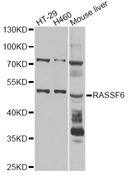 RASSF6 Antibody - Western blot analysis of extracts of various cell lines, using RASSF6 antibody at 1:1000 dilution. The secondary antibody used was an HRP Goat Anti-Rabbit IgG (H+L) at 1:10000 dilution. Lysates were loaded 25ug per lane and 3% nonfat dry milk in TBST was used for blocking. An ECL Kit was used for detection and the exposure time was 15s.