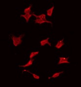 RASSF6 Antibody - Staining HeLa cells by IF/ICC. The samples were fixed with PFA and permeabilized in 0.1% Triton X-100, then blocked in 10% serum for 45 min at 25°C. The primary antibody was diluted at 1:200 and incubated with the sample for 1 hour at 37°C. An Alexa Fluor 594 conjugated goat anti-rabbit IgG (H+L) Ab, diluted at 1/600, was used as the secondary antibody.