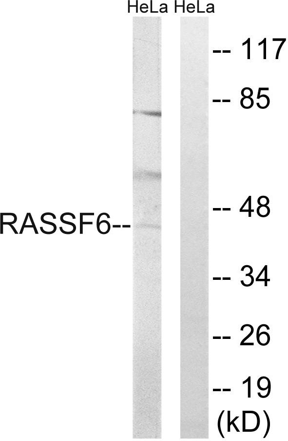 RASSF6 Antibody - Western blot analysis of extracts from HeLa cells, using RASSF6 antibody.