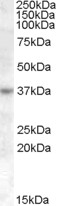 RASSF7 Antibody - Antibody (1 ug/ml) staining of Jurkat cell lysate (35 ug protein in RIPA buffer). Primary incubation was 1 hour. Detected by chemiluminescence.