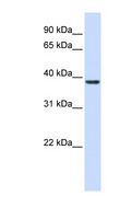 RASSF7 Antibody - RASSF7 antibody Western blot of Fetal Muscle lysate. This image was taken for the unconjugated form of this product. Other forms have not been tested.