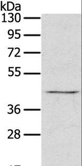 RASSF7 Antibody - Western blot analysis of Raji cell, using RASSF7 Polyclonal Antibody at dilution of 1:800.