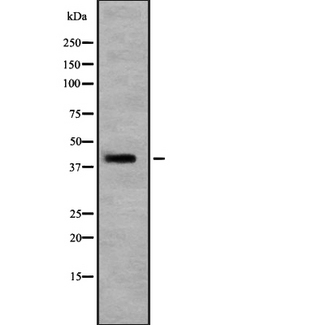 RASSF7 Antibody - Western blot analysis of RASSF7 expression in Jurkat cells lysate. The lane on the left is treated with the antigen-specific peptide.