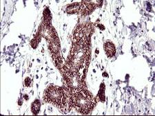 RASSF8 Antibody - IHC of paraffin-embedded Human breast tissue using anti-RASSF8 mouse monoclonal antibody. (Heat-induced epitope retrieval by 10mM citric buffer, pH6.0, 120°C for 3min).