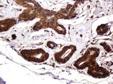 RASSF8 Antibody - IHC of paraffin-embedded Human breast tissue using anti-RASSF8 mouse monoclonal antibody.