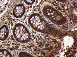 RASSF8 Antibody - IHC of paraffin-embedded Human colon tissue using anti-RASSF8 mouse monoclonal antibody.