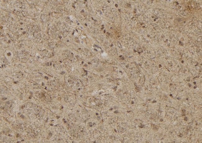 RASSF8 Antibody - 1:100 staining rat brain tissue by IHC-P. The sample was formaldehyde fixed and a heat mediated antigen retrieval step in citrate buffer was performed. The sample was then blocked and incubated with the antibody for 1.5 hours at 22°C. An HRP conjugated goat anti-rabbit antibody was used as the secondary.