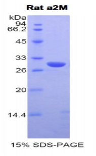 A2M / Alpha-2-Macroglobulin Protein - Recombinant Alpha-2-Macroglobulin By SDS-PAGE
