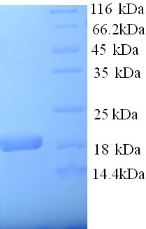 A2M / Alpha-2-Macroglobulin Protein