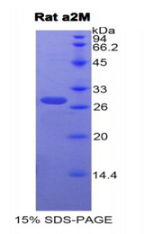 A2M / Alpha-2-Macroglobulin Protein - Recombinant Alpha-2-Macroglobulin By SDS-PAGE