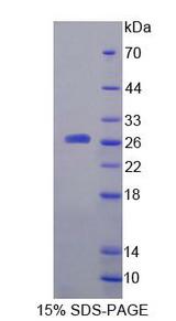 A4GALT Protein - Recombinant Alpha-1,4-Galactosyltransferase (a4GALT) by SDS-PAGE