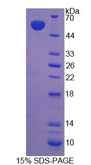ABCC11 / MRP8 Protein - Recombinant ATP Binding Cassette Transporter C11 (ABCC11) by SDS-PAGE