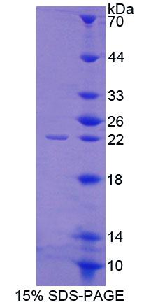 ACD / PTOP Protein - Recombinant Adrenocortical Dysplasia Homolog By SDS-PAGE