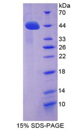 ACE2 / ACE-2 Protein - Recombinant Angiotensin I Converting Enzyme 2 By SDS-PAGE