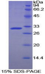 ACP5 / TRAP Protein - Recombinant Acid Phosphatase 5, Tartrate Resistant By SDS-PAGE
