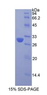 Acrosin Protein - Recombinant Acrosin By SDS-PAGE