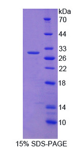 ADAM17 / TACE Protein - Recombinant A Disintegrin And Metalloprotease 17 By SDS-PAGE