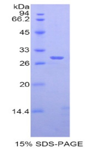 ADAM6 Protein - Recombinant A Disintegrin And Metalloprotease 6 By SDS-PAGE