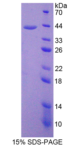 ADAP2 / CENTA2 Protein - Recombinant  Centaurin Alpha 2 By SDS-PAGE