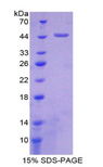 ADGRE5 / CD97 Protein - Recombinant Cluster Of Differentiation 97 By SDS-PAGE