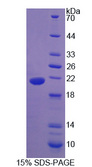 ADIPOR2 Protein - Recombinant AdiPonectin Receptor 2 By SDS-PAGE