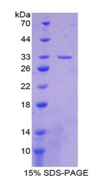 AGRN / Agrin Protein - Recombinant Agrin By SDS-PAGE
